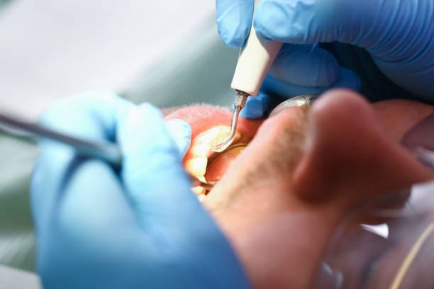 Best Emergency Treatment for Toothache in Lynnville, IN