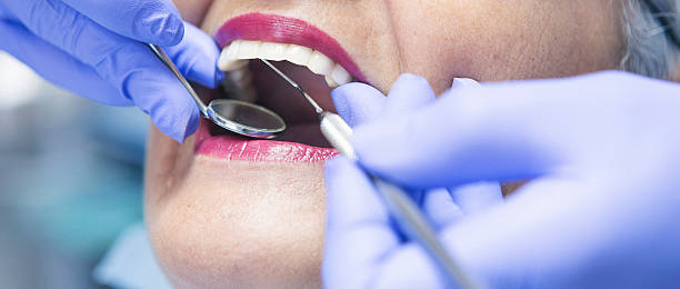 Best Emergency Treatment for Toothache in Lynnville, IN